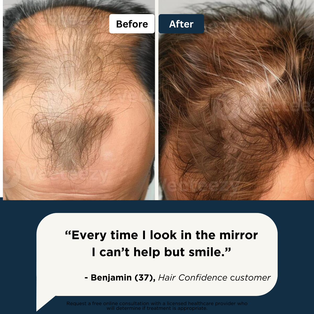 Hair Growth Roll-On Serum